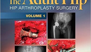 free-pdf-download-The Adult Hip (Two Volume Set): Hip Arthroplasty Surgery Third Edition