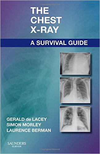 free-pdf-download-The Chest X-Ray: A Survival Guide