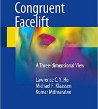 free-pdf-download-The Congruent Facelift: A Three-dimensional View 1st ed. 2018 Edition