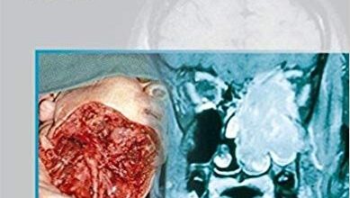 free-pdf-download-The Difficult Case in Head and Neck Cancer Surgery 1st Edition