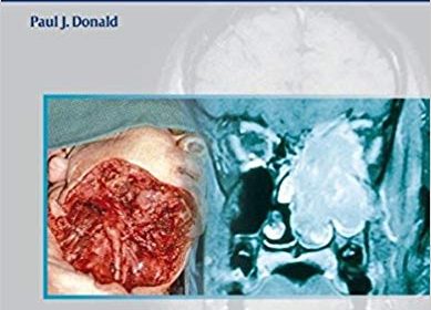 free-pdf-download-The Difficult Case in Head and Neck Cancer Surgery 1st Edition