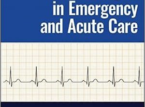 free-pdf-download-The Electrocardiogram in Emergency and Acute Care 1st Edition