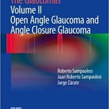 free-pdf-download-The Glaucomas: Volume II – Open Angle Glaucoma and Angle Closure Glaucoma