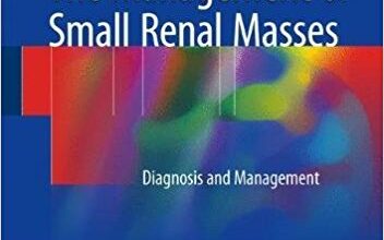 free-pdf-download-The Management of Small Renal Masses: Diagnosis and Management 1st ed. 2018 Edition