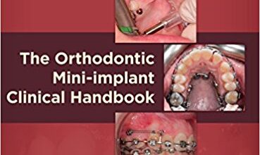 free-pdf-download-The Orthodontic Mini-implant Clinical Handbook 1st Edition