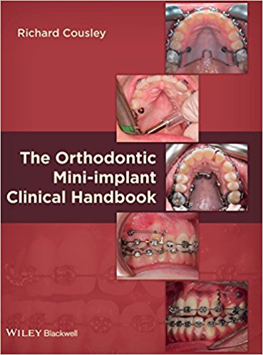 free-pdf-download-The Orthodontic Mini-implant Clinical Handbook 1st Edition