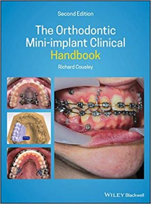 free-pdf-download-The Orthodontic Mini-implant Clinical Handbook 2nd Edition