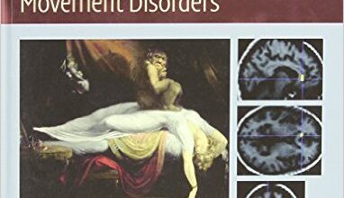 free-pdf-download-The Parasomnias and Other Sleep-Related Movement Disorders (Cambridge Medicine (Hardcover)) 1st Edition