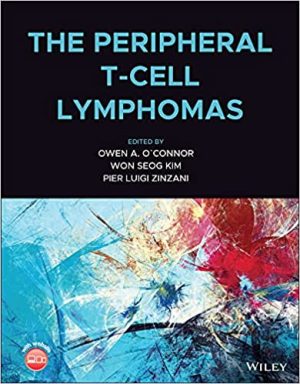 free-pdf-download-The Peripheral T-Cell Lymphomas 1st Edition