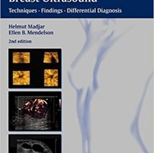 free-pdf-download-The Practice of Breast Ultrasound: Techniques