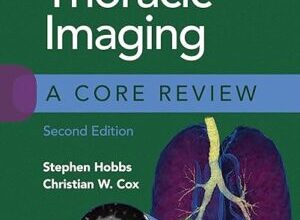 free-pdf-download-Thoracic Imaging: A Core Review 2nd Edition