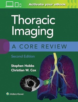 free-pdf-download-Thoracic Imaging: A Core Review 2nd Edition