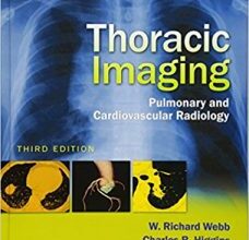 free-pdf-download-Thoracic Imaging: Pulmonary and Cardiovascular Radiology Third Edition