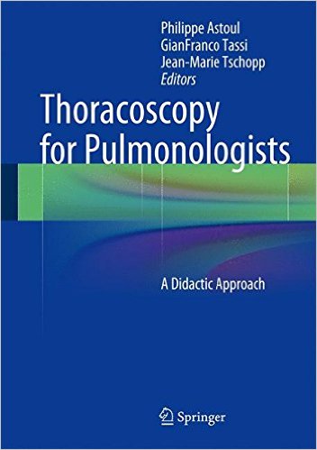 free-pdf-download-Thoracoscopy for Pulmonologists: A Didactic Approach 2014th Edition