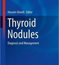 free-pdf-download-Thyroid Nodules: Diagnosis and Management (Contemporary Endocrinology) 1st ed. 2018 Edition