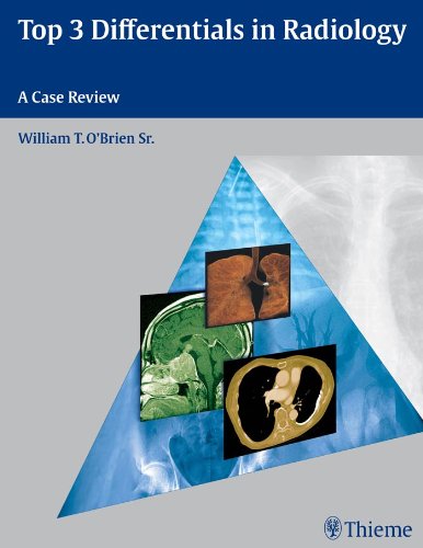 free-pdf-download-Top 3 Differentials in Radiology: A Case Review