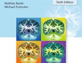 free-pdf-download-Topical Diagnosis in Neurology: Anatomy