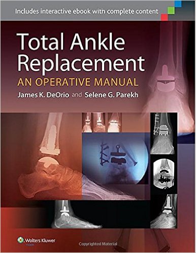 free-pdf-download-Total Ankle Replacement: An Operative Manual First Edition