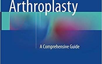 free-pdf-download-Total Knee Arthroplasty: A Comprehensive Guide