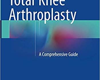 free-pdf-download-Total Knee Arthroplasty: A Comprehensive Guide