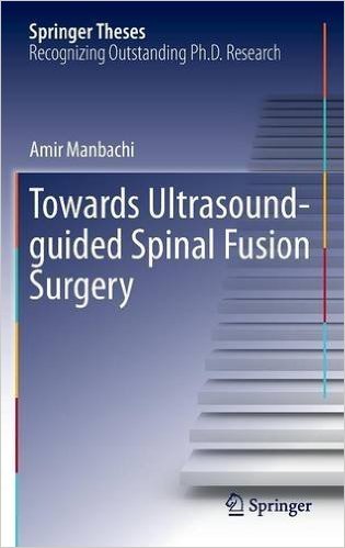 free-pdf-download-Towards Ultrasound-guided Spinal Fusion Surgery (Springer Theses) 1st ed. 2016 Edition