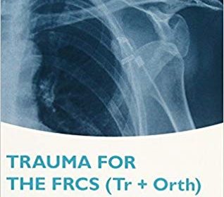 free-pdf-download-Trauma for the FRCS (Tr+Orth) Examination