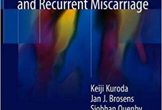 free-pdf-download-Treatment Strategy for Unexplained Infertility and Recurrent Miscarriage 1st ed. 2018 Edition