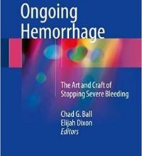 free-pdf-download-Treatment of Ongoing Hemorrhage: The Art and Craft of Stopping Severe Bleeding 1st ed. 2018 Edition