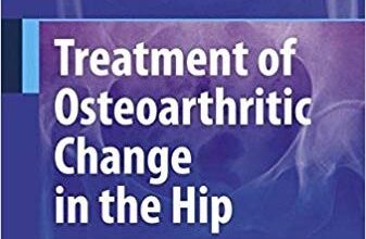 free-pdf-download-Treatment of Osteoarthritic Change in the Hip: Joint Preservation or Joint Replacement