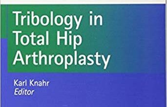 free-pdf-download-Tribology in Total Hip Arthroplasty (EFORT Reference in Orthopaedics and Traumatology)