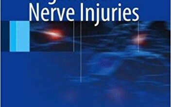 free-pdf-download-Trigeminal Nerve Injuries