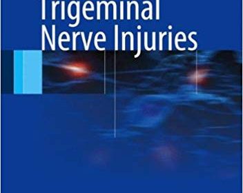 free-pdf-download-Trigeminal Nerve Injuries