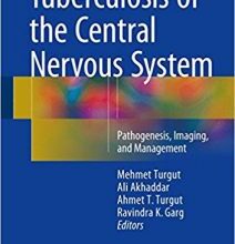 free-pdf-download-Tuberculosis of the Central Nervous System: Pathogenesis