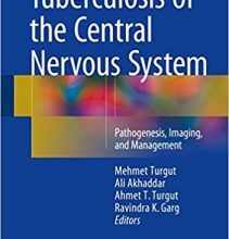 free-pdf-download-Tuberculosis of the Central Nervous System: Pathogenesis