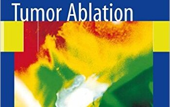 free-pdf-download-Tumor Ablation: Principles and Practice 2005th Edition