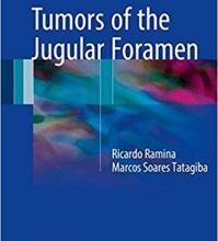 free-pdf-download-Tumors of the Jugular Foramen 1st ed. 2017 Edition