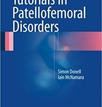 free-pdf-download-Tutorials in Patellofemoral Disorders 1st ed. 2017 Edition