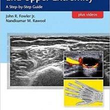 free-pdf-download-Ultrasound of the Hand and Upper Extremity: A Step-by-Step Guide