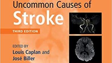 free-pdf-download-Uncommon Causes of Stroke 3rd Edition