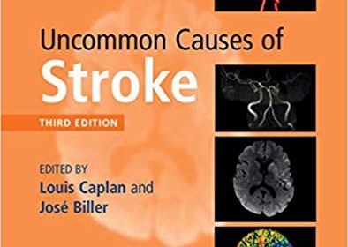 free-pdf-download-Uncommon Causes of Stroke 3rd Edition