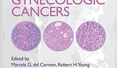 free-pdf-download-Uncommon Gynecologic Cancers