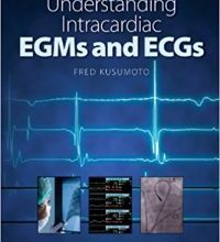 free-pdf-download-Understanding Intracardiac EGMs and ECGs 1st Edition