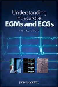 free-pdf-download-Understanding Intracardiac EGMs and ECGs 1st Edition