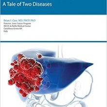 free-pdf-download-Understanding Liver Cancer: A Tale of Two Diseases