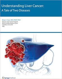 free-pdf-download-Understanding Liver Cancer: A Tale of Two Diseases