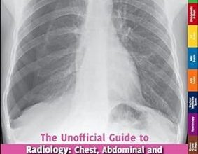 free-pdf-download-Unofficial Guide to Radiology: Chest