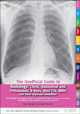 free-pdf-download-Unofficial Guide to Radiology: Chest