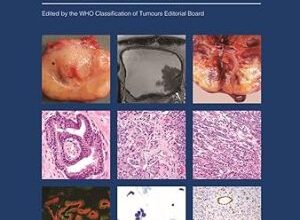 free-pdf-download-Urinary and Male Genital Tumours (WHO Classification of Tumours