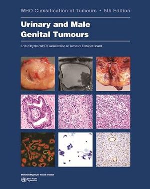 free-pdf-download-Urinary and Male Genital Tumours (WHO Classification of Tumours