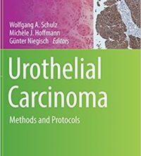 free-pdf-download-Urothelial Carcinoma: Methods and Protocols (Methods in Molecular Biology) 1st ed